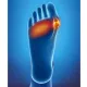 Epitact Coussinet Double Protection
