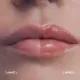 Filorga Hyalu-Filler Lips