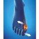 Epitact Hallux Valgus Orthèse Corrective de Nuit